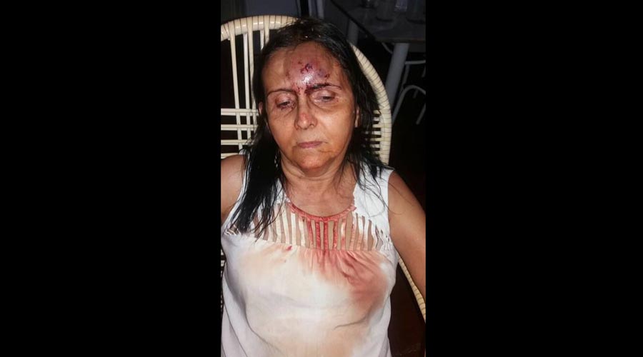 mulher agredida