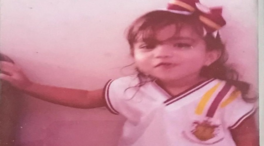 menina-queimaduras-inga