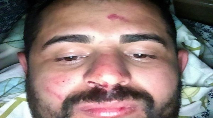 Professor de Catingueira, Olegário Gomes, se defende sobre agressão a jovem Alisson: “fui agredido primeiro”