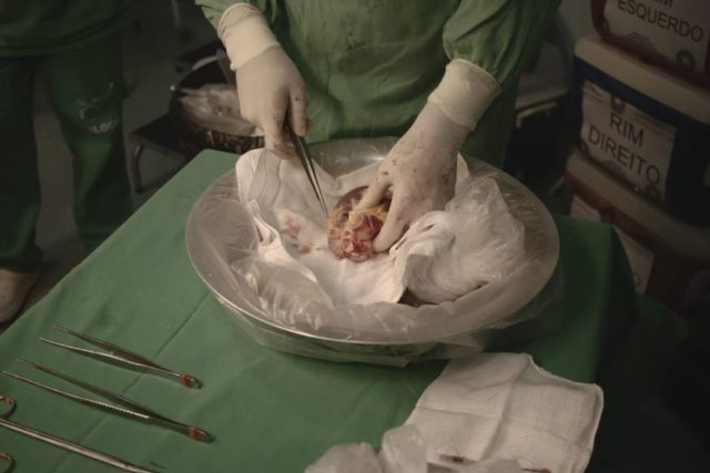 transplante