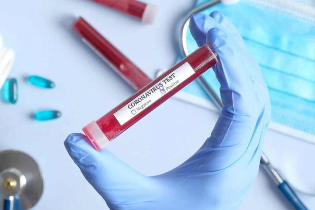 coronavirus-test
