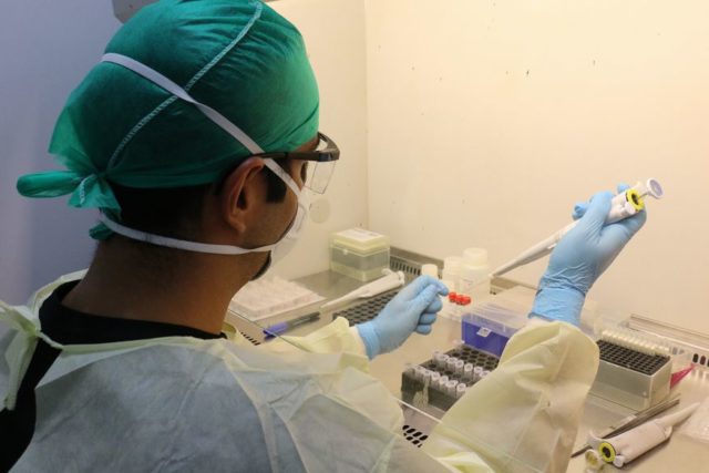 exame_-_coronavirus_-_lacen_paraiba