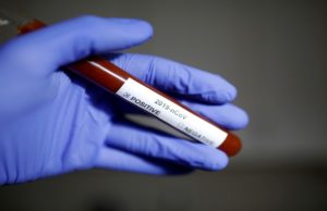 Paraíba registra 15 novas mortes por Covid-19 e chega a 2.465