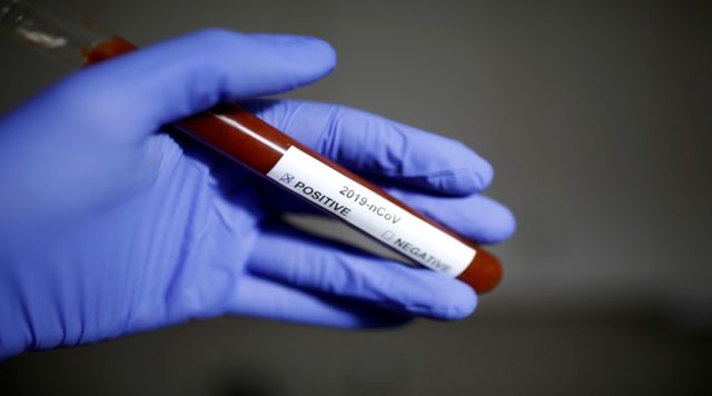 teste-coronavirus-1