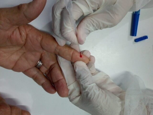 testagem