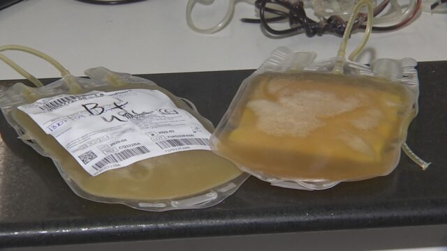 plasma-coronavirus
