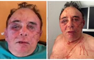 Candidato a prefeito de Santa Terezinha tem casa invadida e é espancado por grupo armado – mais informações