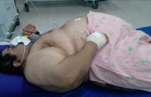 Morre no Rio Grande do Norte paciente com quase 300 quilos que aguardou cinco dias por vaga em UTI em colchão no chão