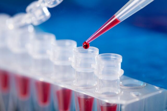 blood-test_1-scaled
