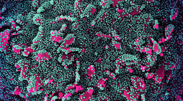coronavirus