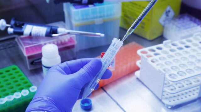 diagnostico_novo_coronavirus_fiocruz_covid_19-5