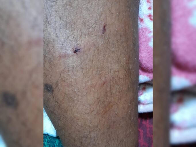 Mordida-de-cachorro-Patosonline.com_