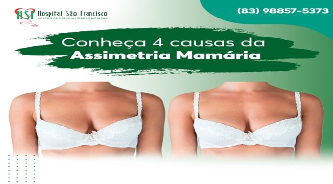 assimetria-mamaria