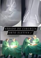 Foram realizadas oito cirurgias ortop dicas no plant o