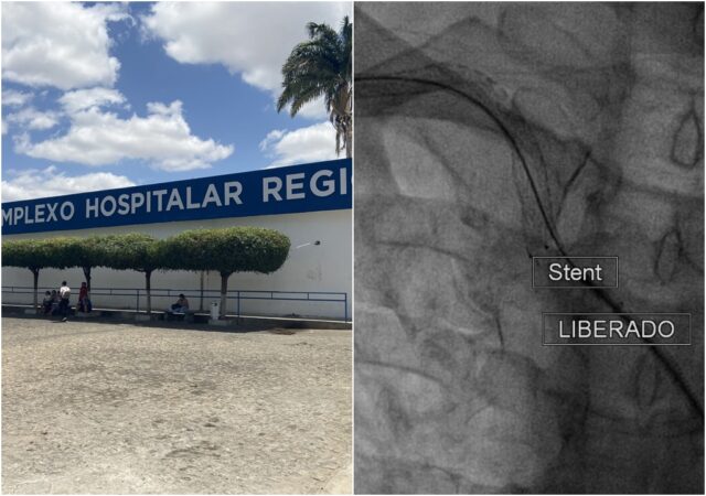 Hospital-e-Stent