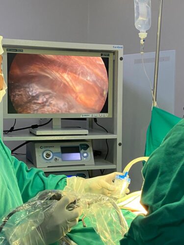 O hospital tambem realizou cirurgias por videolaparoscopia