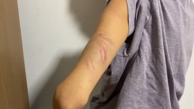 pedrohugotvcabobranco