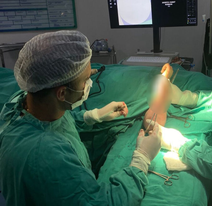 Uma-das-cirurgias-ortopedicas-realizada-durante-o-plantao-do-final-de-semana
